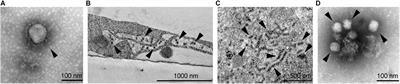 Neurotropic Viruses, Astrocytes, and COVID-19